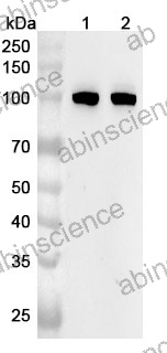 Anti-S6K1/RPS6KB1 Polyclonal Antibody