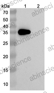 Anti-Human Coagulation factor III/Tissue factor Reference Antibody (Samatatug, RUO)