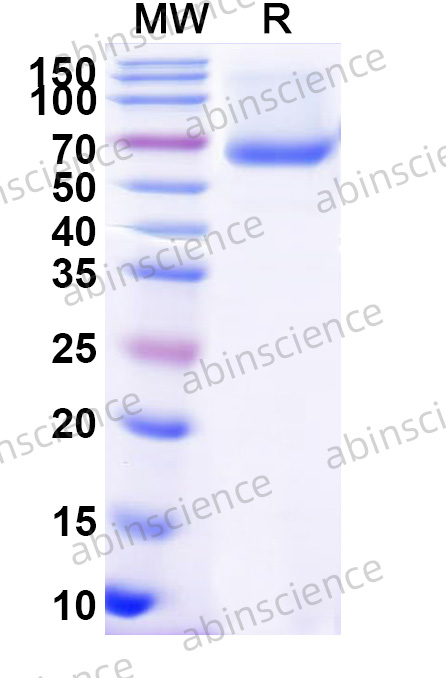 Human CD120b/TNFRSF1B/TNFR2 Recombinant Protein (C-Fc)