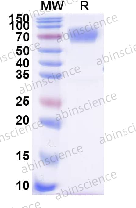 Human CD58 Recombinant Protein (C-Fc)