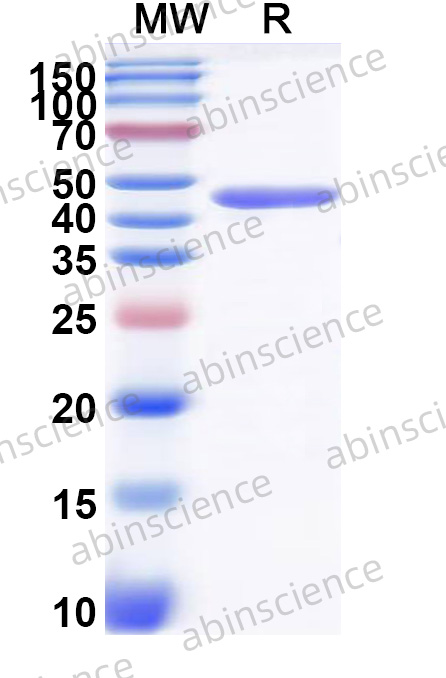 Human PTX3 Recombinant Protein (C-His)