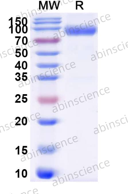 Human CD116/CSF2RA Recombinant Protein (C-Fc)
