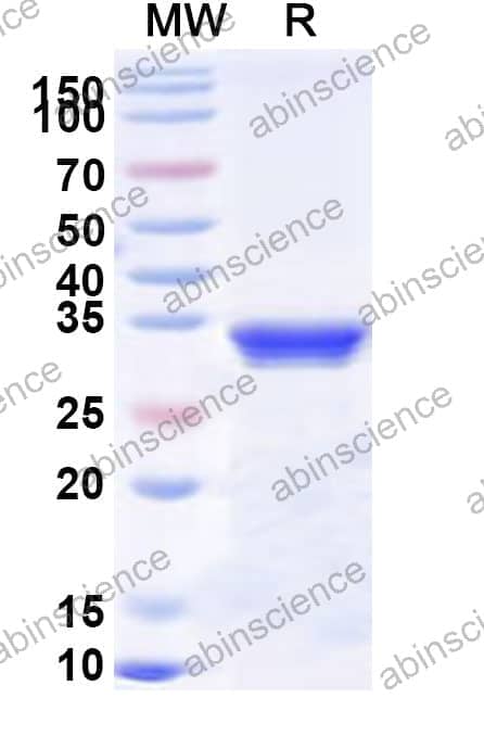 Human ITGA3/CD49c Recombinant Protein (N-His)
