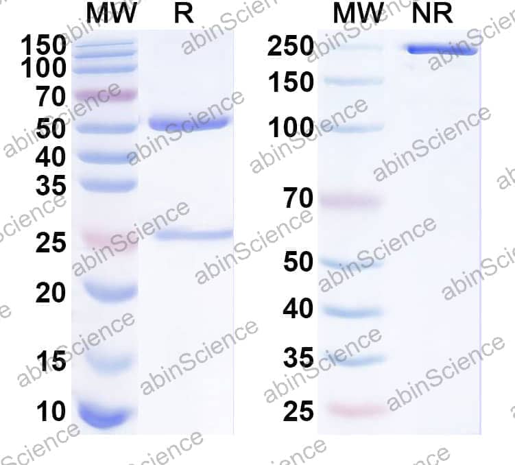 Anti-Human GJB2 Recombinant Antibody (SAA1838)