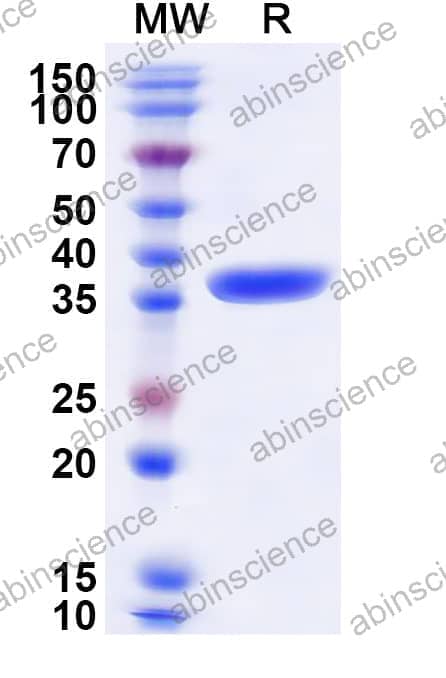 Human ATF6 Recombinant Protein (N-GST&C-His)