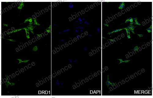 Anti-Human DRD1/AGIA Recombinant Antibody (SAA0783)