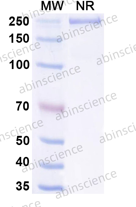 Anti-Human DRD1/AGIA Recombinant Antibody (SAA0783)