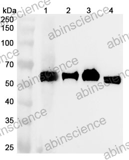 Anti-Human ARSA Polyclonal Antibody
