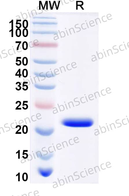 Human ACP3 Recombinant Protein (N-His)