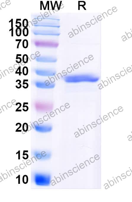 Human CD72 Recombinant Protein (N-His)