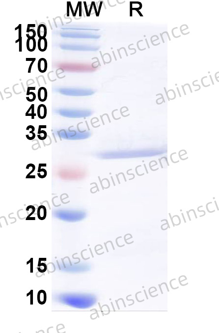 Human PROZ Recombinant Protein (N-His)
