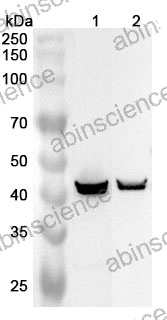 Anti-TMOD1 Polyclonal Antibody
