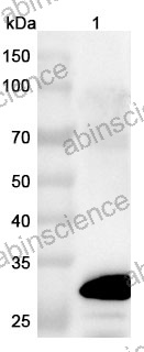 Anti-Human CD182/CXCR2 Recombinant Nanobody (SAA1360)