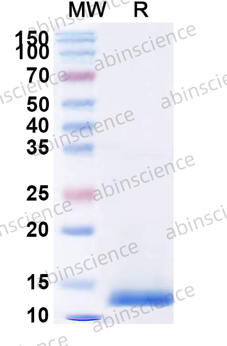 Human TSPO Recombinant Protein (N-His)