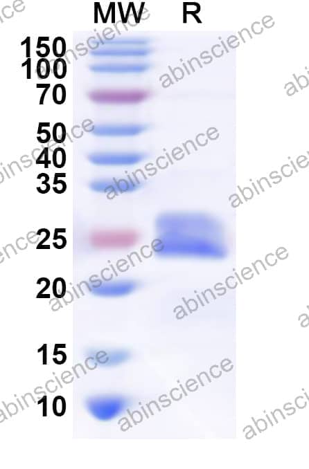 Human TMEM201 Recombinant Protein (N-His)