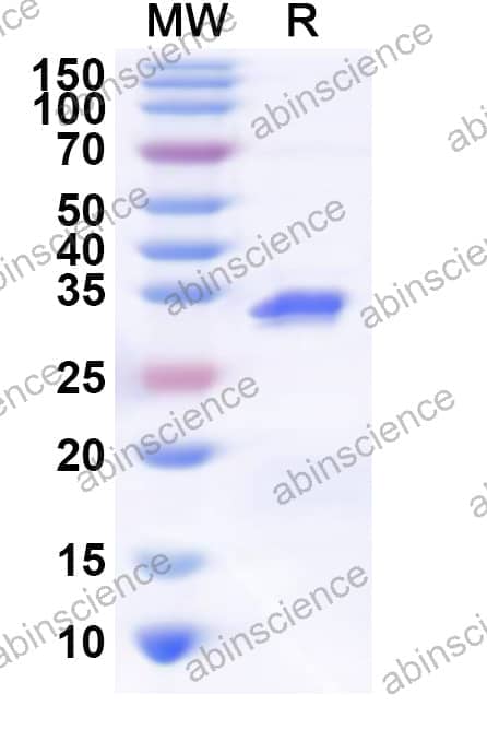 Human HP1BP3 Recombinant Protein (N-His)