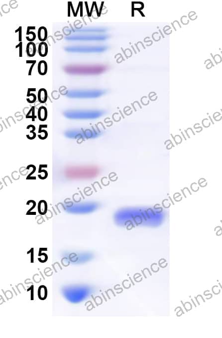 Human LDLRAP1 Recombinant Protein (N-His)