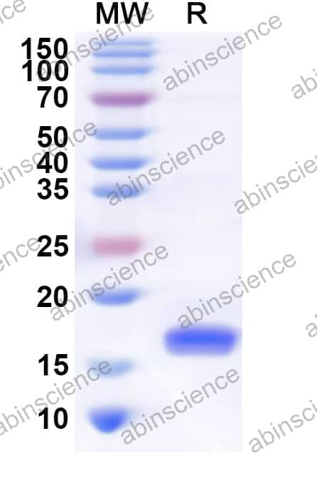 Recombinant Human TREML2 Protein, N-His