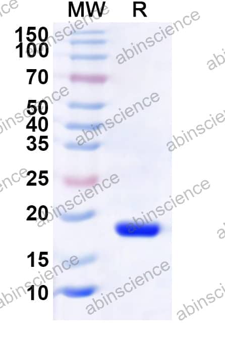 Human BRMS1L Recombinant Protein (N-His)