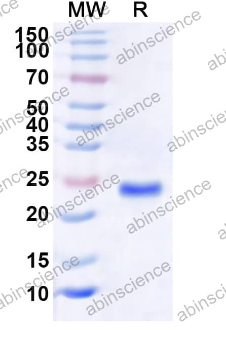 Human RTP2 Recombinant Protein (N-His)