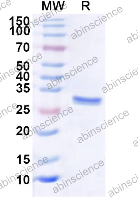 Human EXOSC6 Recombinant Protein (N-His)
