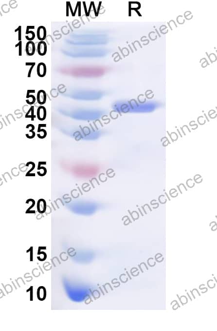 Human DDX59 Recombinant Protein (N-His)