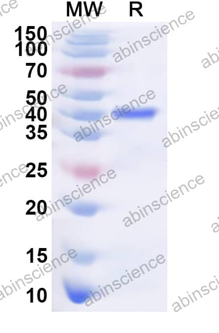Human DCAF8 Recombinant Protein (N-His)