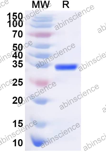 Human PARP6 Recombinant Protein (N-His)