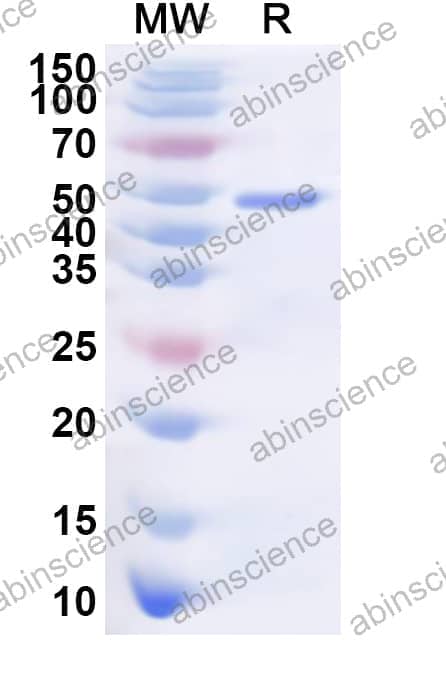 Human STRIP1 Recombinant Protein (N-His)
