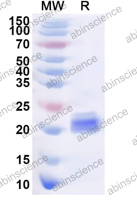 Human GFI1B Recombinant Protein (N-His)