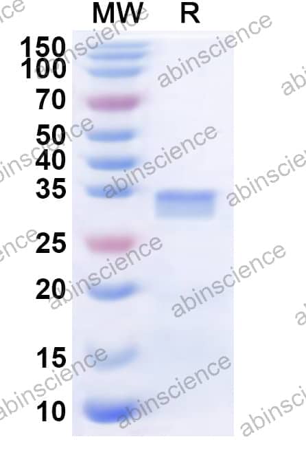 Human CDC42BPG Recombinant Protein (N-His)