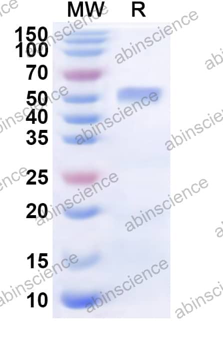 Human SEMA3B Recombinant Protein (N-His)