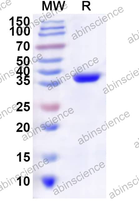Human FOXK1 Recombinant Protein (N-His)