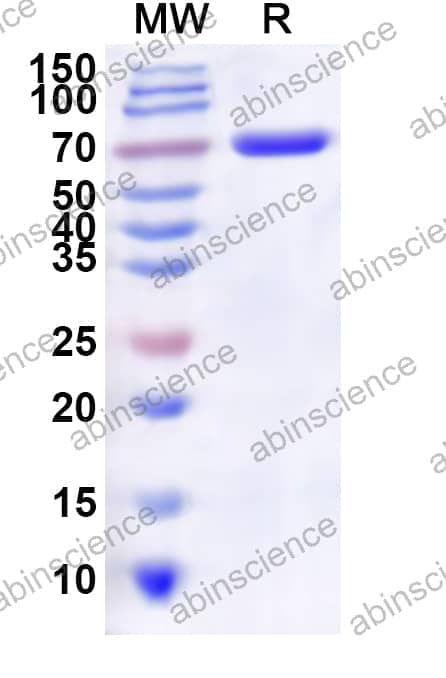 Human ATP11A Recombinant Protein (N-His)