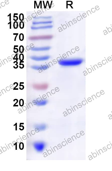 Human CDK3 Recombinant Protein (N-His)