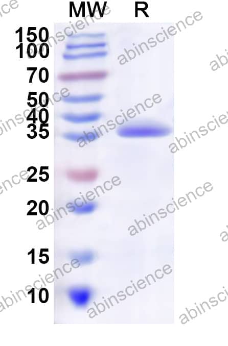 Human PCDH1 Recombinant Protein (N-His)