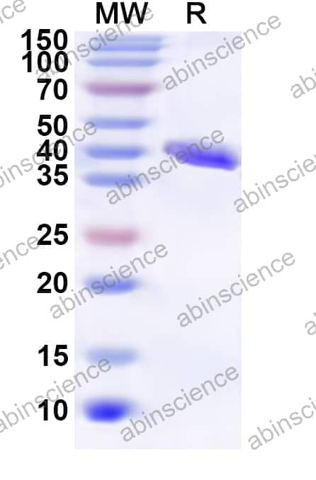 Human RPL26 Recombinant Protein (N-GST & C-His)