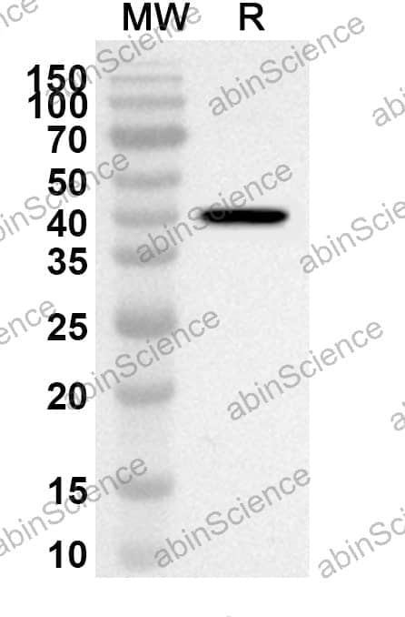 Anti-RPL26 Polyclonal Antibody