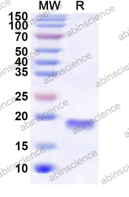 Human FLOT2 Recombinant Protein (N-His)