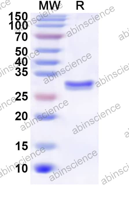 Human ABCC10 Recombinant Protein (N-His)