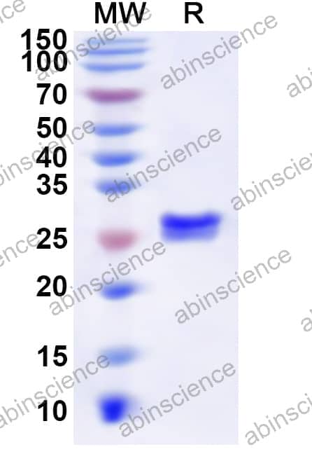 Human HNRNPF Recombinant Protein (N-His)