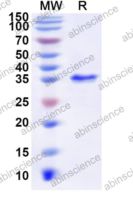 Human SUB1 Recombinant Protein (N-GST & C-His)