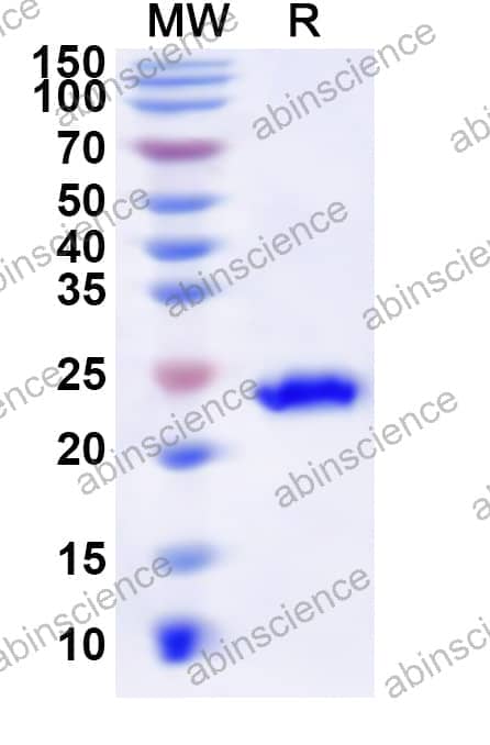 Human CABP4 Recombinant Protein (N-His)