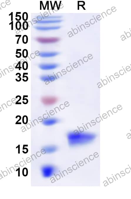 Human MTPN Recombinant Protein (N-His)