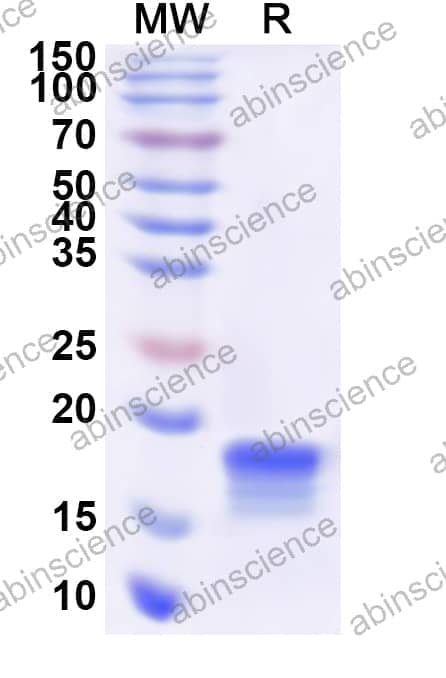 Human RGS8 Recombinant Protein (N-His)