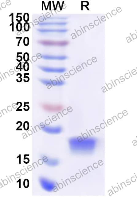 Human UBE2N Recombinant Protein (N-His)
