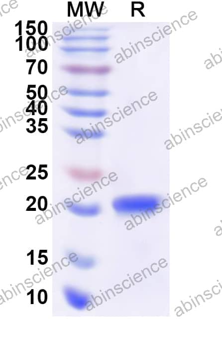 Human NCS1 Recombinant Protein (N-His)