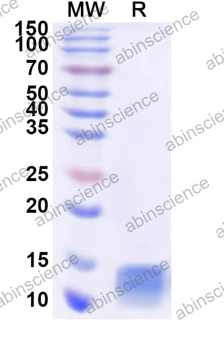 Human PCBD1 Recombinant Protein (N-His)
