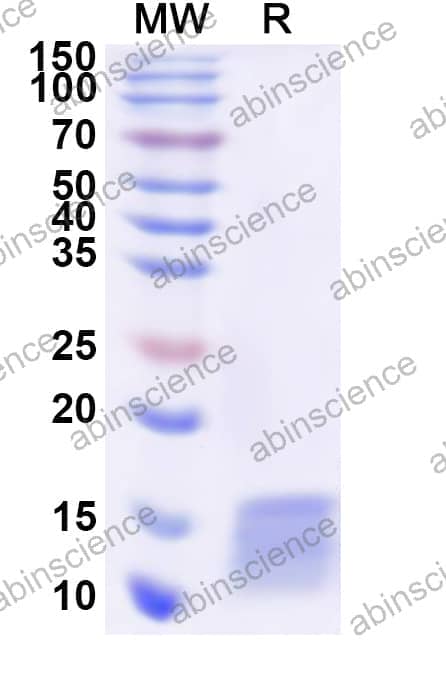 Human POLR2J Recombinant Protein (N-His)