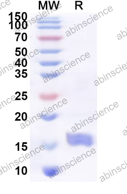 Human CD300H Recombinant Protein (N-His)